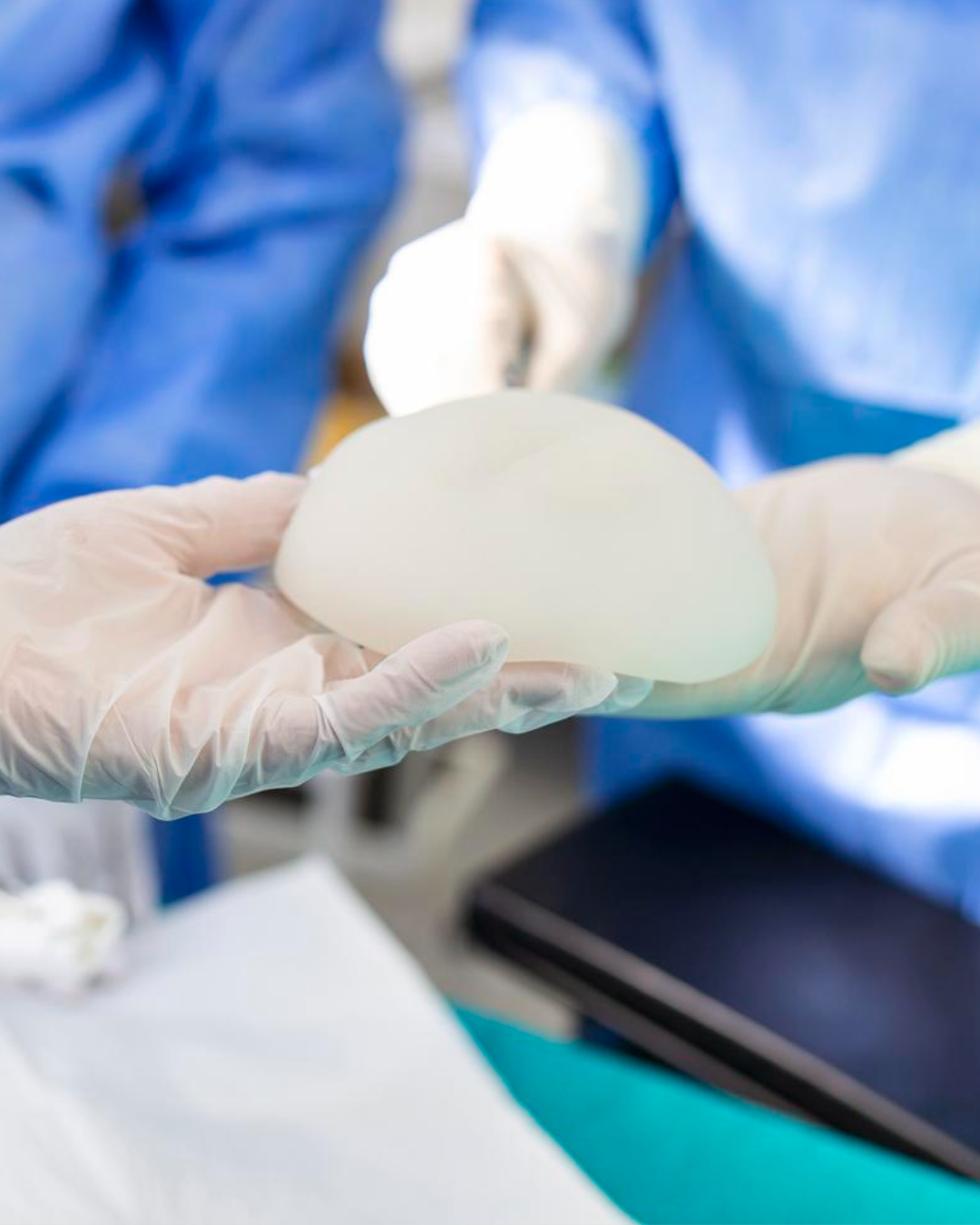 Preciso trocar a prótese de silicone depois de 10 anos?